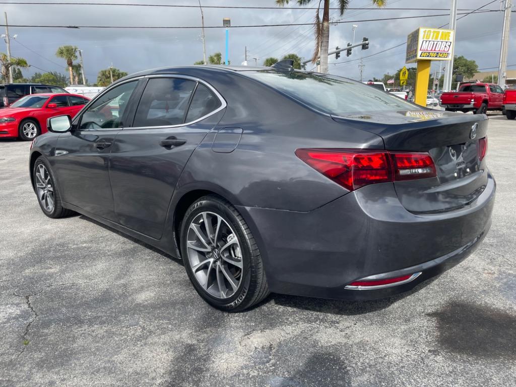 2015 Acura TLX Technology Package photo 4